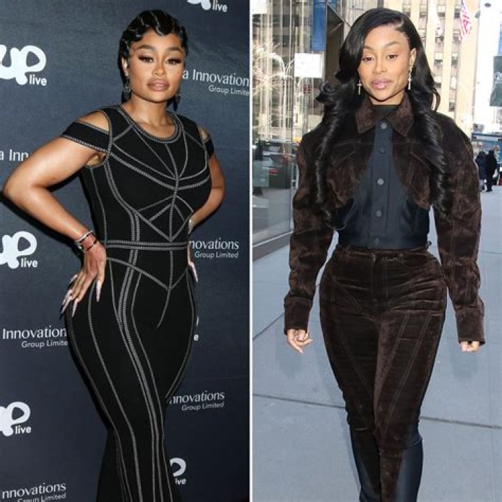 ‘You Look Good’:  Blac Chyna Shows Off Her Snatched Figure In New Photos Since Reversing Her Plastic Surgery